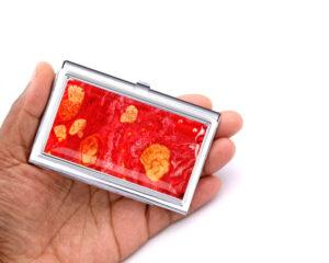 Metal Credit Card Holder Bus101, Laying On A woman's Hand To Show The Size. Designed By Terlis Designs.